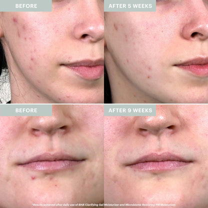 Clear Skin Hydration Duo - Travel Size - Glo Skin Beauty UK&I