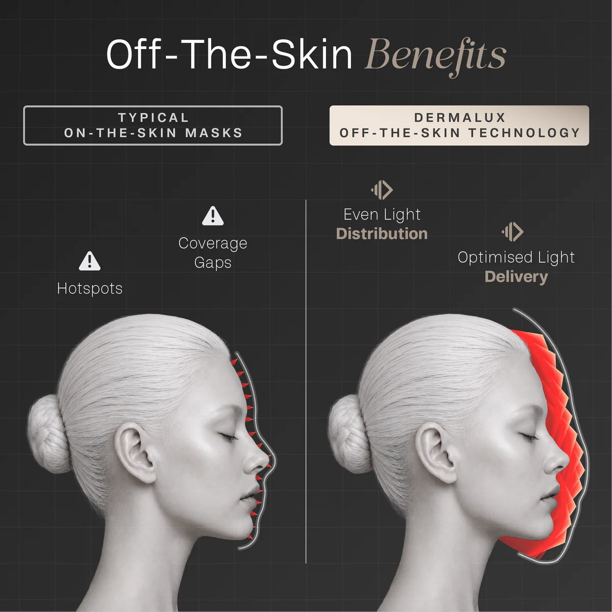 Off-the-skin benefits in profile. A typical on-the-skin mask produces hotspots and coverage gaps along the contour of the face. Dermalux holds the array away from the skin for even light distribution and optimised light delivery.